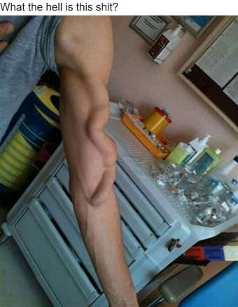 picture