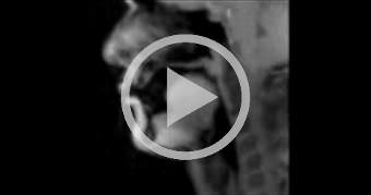 Beatboxing in real time (MRI)